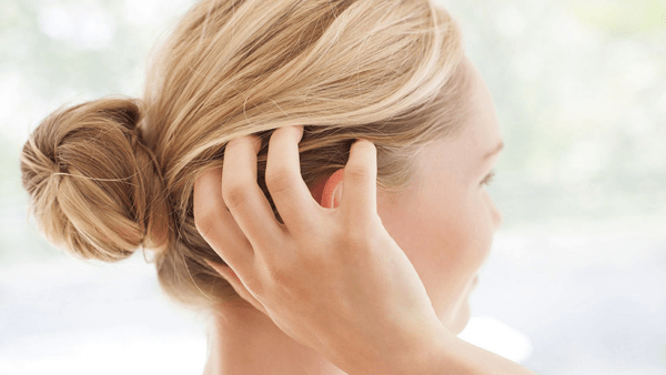 Relieve a Dry, Itchy Scalp Naturally